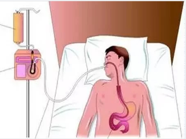 ���������ʳ����ʳ������